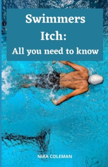 Image for Swimmers Itch : All you need to know: What ??n be d?n? t? reduce the r??k ?f swimmer's itch?