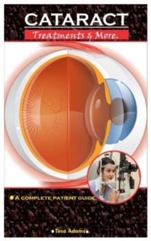 Image for CATARACT. Treatment & More : A Complete Patient Guide