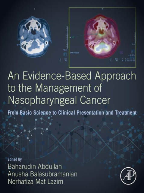 Evidence-Based Approach to the Management of Nasopharyngeal Cancer