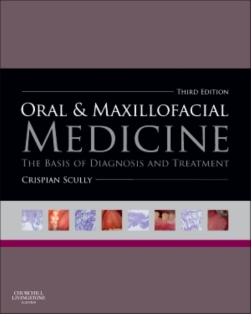 Oral and Maxillofacial Medicine