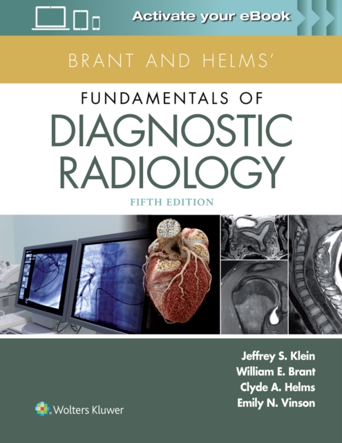 Brant and Helms Fundamentals of Diagnostic Radiology