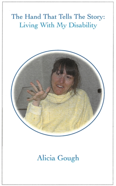 Hand That Tells The Story  Living With My Disability