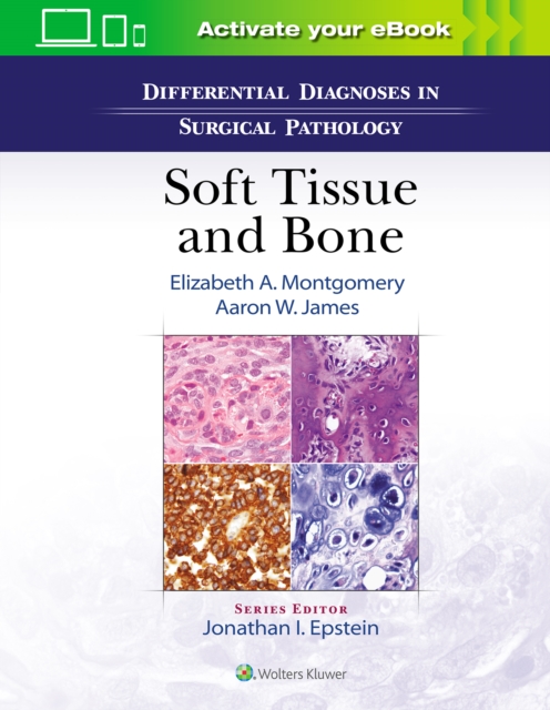 Differential Diagnoses in Surgical Pathology Soft Tissue and Bone